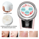 Aparelho de Lifting Facial Microfocado Reparador de Linhas de Expressão - Derma Lift + Máscara Facial Grátis