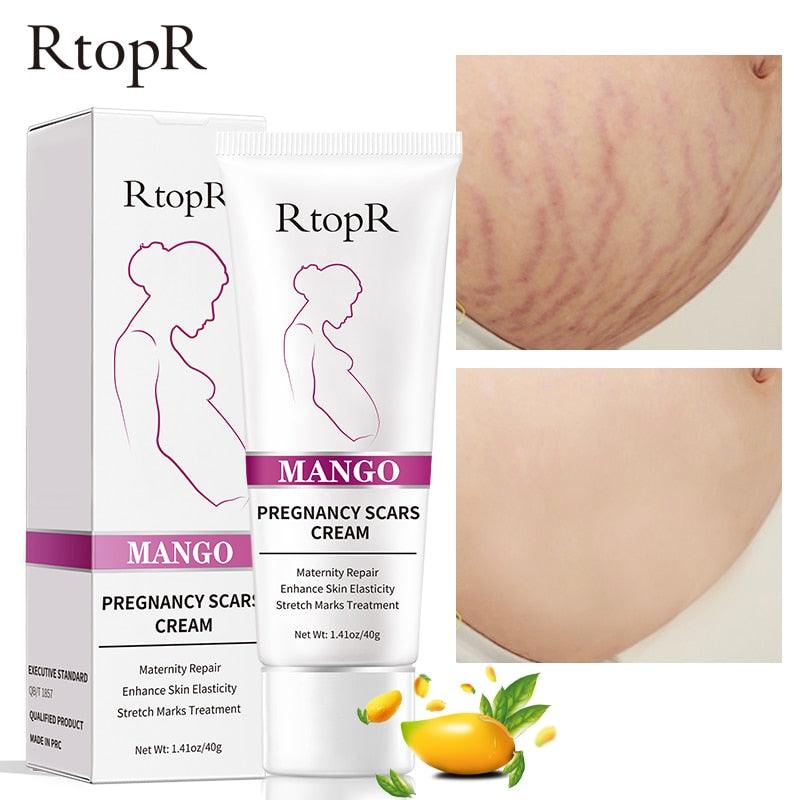 Creme Revitalizador Removedor de Estrias e Cicatrizes