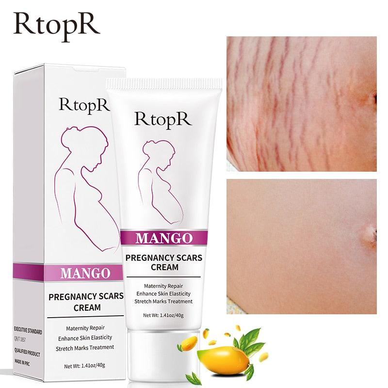 Creme Revitalizador Removedor de Estrias e Cicatrizes