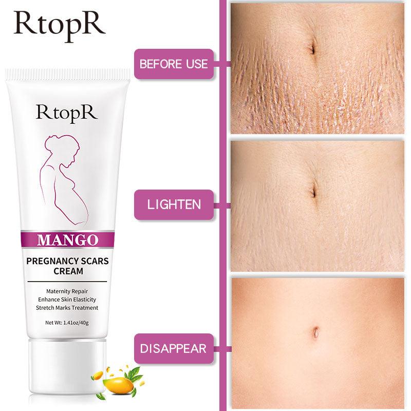 Creme Revitalizador Removedor de Estrias e Cicatrizes