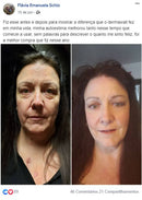 Aparelho de Radiofrequência Reparador de Linhas de Expressão - Derma Wall® + Necessaire Grátis